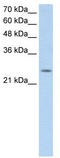 Fatty Acid Hydroxylase Domain Containing 2 antibody, TA329495, Origene, Western Blot image 