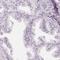 Chromosome 1 Open Reading Frame 194 antibody, HPA049684, Atlas Antibodies, Immunohistochemistry frozen image 