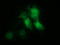 Musashi RNA Binding Protein 1 antibody, LS-C174756, Lifespan Biosciences, Immunofluorescence image 