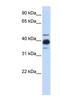 Heterogeneous Nuclear Ribonucleoprotein C (C1/C2) antibody, NBP1-57153, Novus Biologicals, Western Blot image 