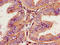 Prokineticin Receptor 2 antibody, LS-C673456, Lifespan Biosciences, Immunohistochemistry paraffin image 
