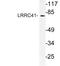 Leucine Rich Repeat Containing 41 antibody, AP21191PU-N, Origene, Western Blot image 