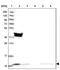 Mitochondrial import inner membrane translocase subunit Tim10 antibody, PA5-59002, Invitrogen Antibodies, Western Blot image 