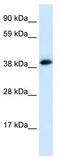 Cholinergic Receptor Nicotinic Alpha 1 Subunit antibody, TA330009, Origene, Western Blot image 