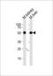 Casein Kinase 1 Gamma 3 antibody, GTX53489, GeneTex, Western Blot image 