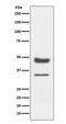 Paired Box 6 antibody, M00273-3, Boster Biological Technology, Western Blot image 