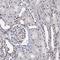 Methyltransferase Like 14 antibody, HPA038002, Atlas Antibodies, Immunohistochemistry frozen image 