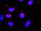 Clathrin Heavy Chain antibody, H00001213-M05, Novus Biologicals, Proximity Ligation Assay image 