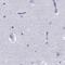 Stromal Antigen 3 antibody, PA5-61883, Invitrogen Antibodies, Immunohistochemistry frozen image 