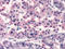 Somatostatin receptor type 5 antibody, TA317368, Origene, Immunohistochemistry paraffin image 