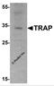 Acid Phosphatase 5, Tartrate Resistant antibody, 6911, ProSci, Western Blot image 