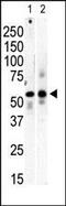 Phosphatidylinositol 4-Kinase Type 2 Beta antibody, PA5-15277, Invitrogen Antibodies, Western Blot image 
