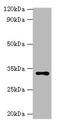Hydroxysteroid 11-Beta Dehydrogenase 1 antibody, CSB-PA010763LA01HU, Cusabio, Western Blot image 