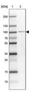 Zinc Finger Protein 281 antibody, PA5-62351, Invitrogen Antibodies, Western Blot image 