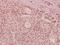 Netrin 1 antibody, A04892-1, Boster Biological Technology, Immunohistochemistry paraffin image 