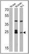 Recoverin antibody, MA1-932, Invitrogen Antibodies, Western Blot image 