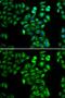 Dopamine Receptor D5 antibody, GTX54003, GeneTex, Immunofluorescence image 