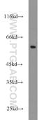Cytochrome P450 Family 4 Subfamily F Member 12 antibody, 13243-1-AP, Proteintech Group, Western Blot image 