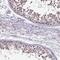 Centrosomal Protein 55 antibody, HPA023430, Atlas Antibodies, Immunohistochemistry frozen image 
