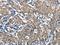 Hepatocyte Growth Factor antibody, orb518999, Biorbyt, Immunohistochemistry paraffin image 