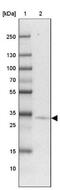 3-Hydroxyacyl-CoA Dehydratase 4 antibody, NBP2-31725, Novus Biologicals, Western Blot image 
