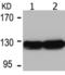 Histone deacetylase 5 antibody, TA323445, Origene, Western Blot image 