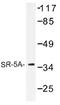 5-Hydroxytryptamine Receptor 5A antibody, AP01292PU-N, Origene, Western Blot image 