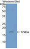 Atrial natriuretic peptide-converting enzyme antibody, LS-C293530, Lifespan Biosciences, Western Blot image 