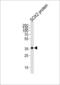 SRY-Box 2 antibody, LS-C96467, Lifespan Biosciences, Western Blot image 