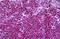 Neurofibromin antibody, MBS244810, MyBioSource, Immunohistochemistry paraffin image 