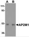 AP-2 complex subunit mu antibody, 5161, ProSci Inc, Western Blot image 