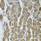 Ubiquinol-Cytochrome C Reductase Core Protein 1 antibody, 19-039, ProSci, Immunohistochemistry paraffin image 