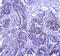 Integrin Subunit Alpha 2b antibody, PA5-79526, Invitrogen Antibodies, Immunohistochemistry paraffin image 