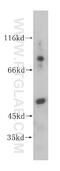 Galactosamine (N-Acetyl)-6-Sulfatase antibody, 14933-1-AP, Proteintech Group, Western Blot image 