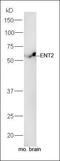 Solute Carrier Family 29 Member 2 antibody, orb183481, Biorbyt, Western Blot image 