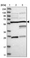 Centrobin, Centriole Duplication And Spindle Assembly Protein antibody, NBP1-82835, Novus Biologicals, Western Blot image 