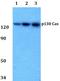p130cas antibody, A00960Y249, Boster Biological Technology, Western Blot image 