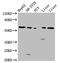 UDP Glucuronosyltransferase Family 1 Member A1 antibody, CSB-PA025570LA01HU, Cusabio, Western Blot image 