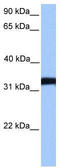 Lactate Dehydrogenase C antibody, TA335841, Origene, Western Blot image 