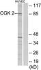 cGMP-dependent protein kinase 2 antibody, TA314390, Origene, Western Blot image 