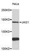 Jagged Canonical Notch Ligand 1 antibody, STJ114606, St John