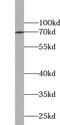 Zinc Finger Protein 74 antibody, FNab09734, FineTest, Western Blot image 