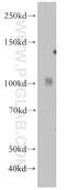 Inositol Polyphosphate-5-Phosphatase J antibody, 21417-1-AP, Proteintech Group, Western Blot image 