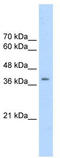 Cyclin Dependent Kinase 9 antibody, TA330349, Origene, Western Blot image 