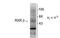 Retinoid X Receptor Beta antibody, TA309231, Origene, Western Blot image 