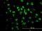 Serine And Arginine Rich Splicing Factor 5 antibody, H00006430-B01P, Novus Biologicals, Immunocytochemistry image 