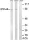 Ubiquitin Specific Peptidase 44 antibody, LS-C199712, Lifespan Biosciences, Western Blot image 