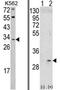Integral Membrane Protein 2A antibody, AP17512PU-N, Origene, Western Blot image 