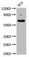 Keratin 76 antibody, CSB-PA012570LA01HU, Cusabio, Western Blot image 