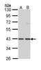 E2F-1 antibody, PA5-22253, Invitrogen Antibodies, Western Blot image 